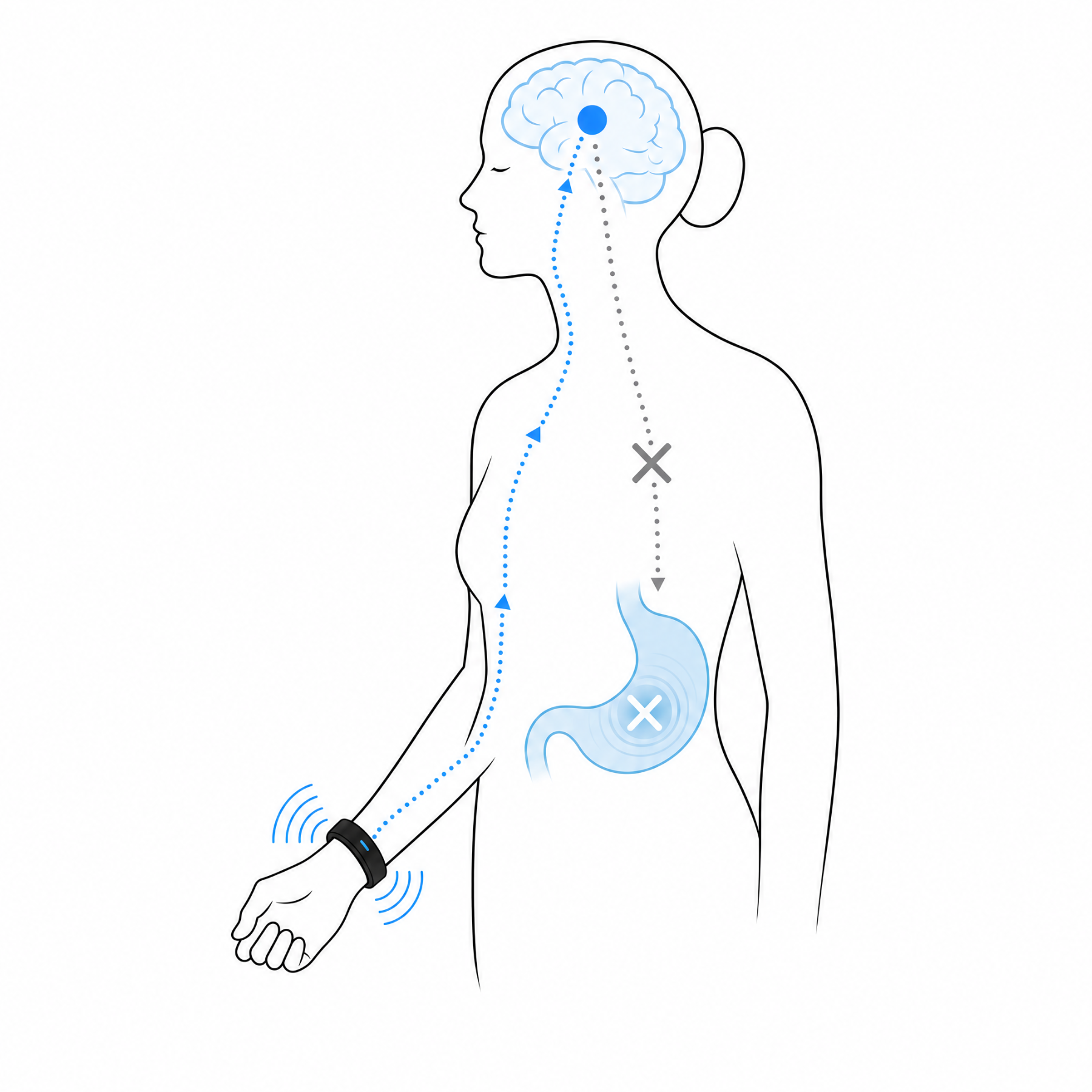Charmp Anti-Nausea Wristband