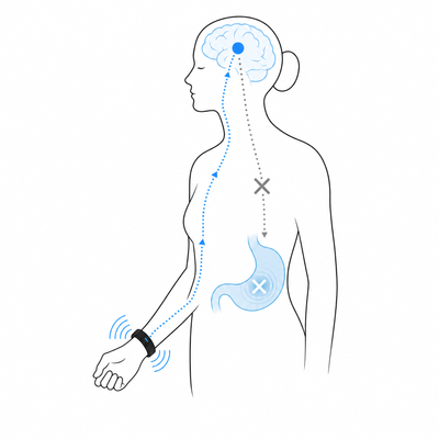 Charmp Anti-Nausea Wristband